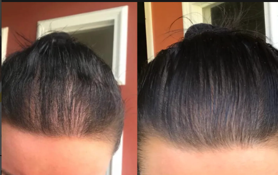 Fleava Hair Reviews Before and After